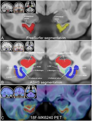 Tau PET burden in Brodmann areas 35 and 36 is associated with individual differences in cognition in non-demented older adults